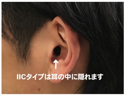 耳あな型補聴器 IIC a2