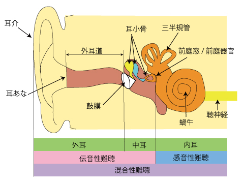 感音性難聴 聞こえ方 耳の部位と難聴の種類
