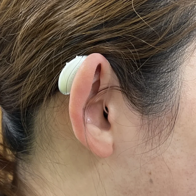 耳かけ型補聴器 ユニトロン モクシ―ビバンテ R【Unitron Moxi Vivante R】