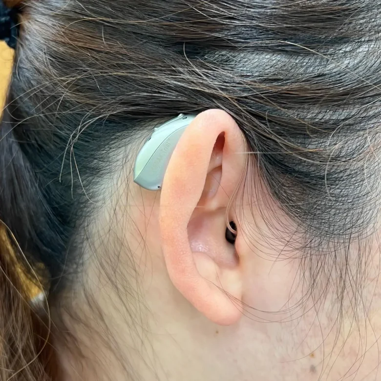 耳かけ型補聴器 フォナック オーデオ インフィニオ スフィア【Phonak Audeo Infinio sphere】装用