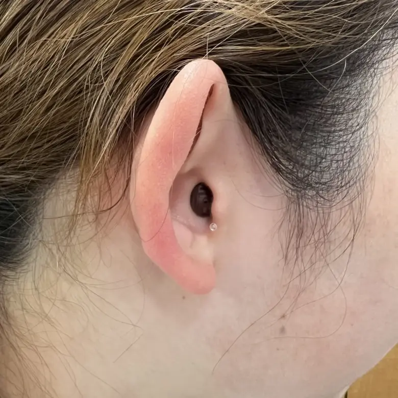 耳あな型補聴器 スターキー シグネチャーIIC【Starkey Signeture IIC】装着