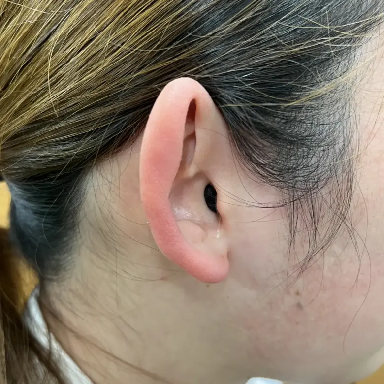 耳あな型補聴器 オーティコン オウンSI IIC【oticon own IIC】装用