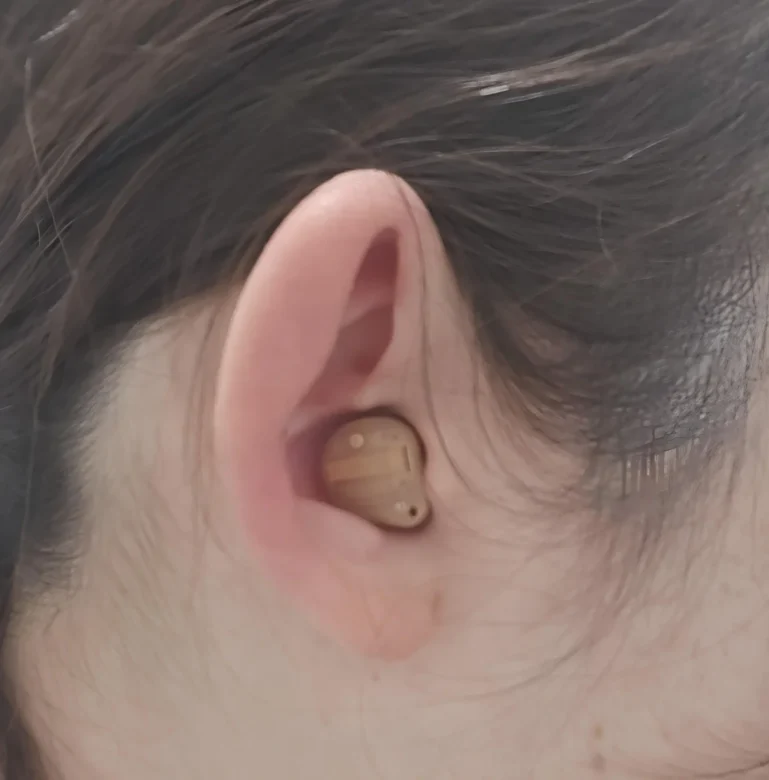 耳あな型補聴器 シグニア インシオ IX【signia Insio IX】装用